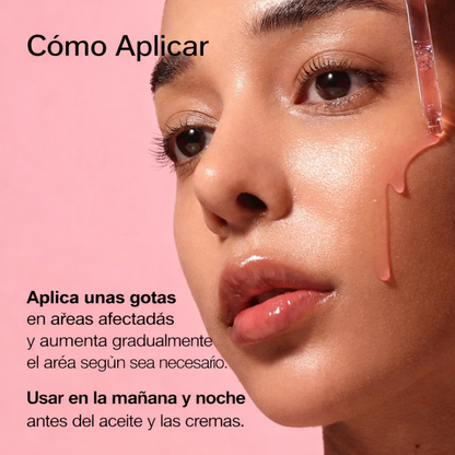 Niacinamida 10% + TXA 4% Anua